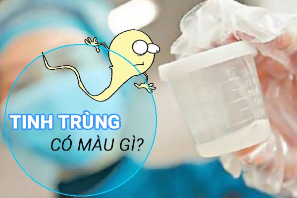 Cách nhận biết chồng ngoại tình qua màu của tinh trùng